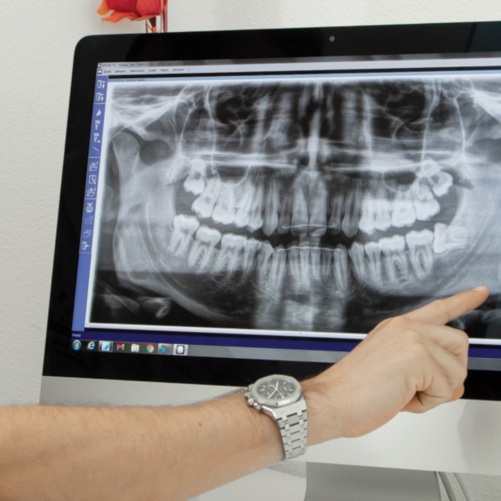 Dentista a Biasca? Clinica Dentaria 3 Valli è Odontoiatria, Ortodonzia Invisibile, Implantologia e Chirurgia Orale.